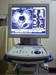 IVUS 写真